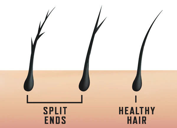 Split-Ends-Hair-Everything-you-need-to-know-and-How-to-Get-Rid-of-It