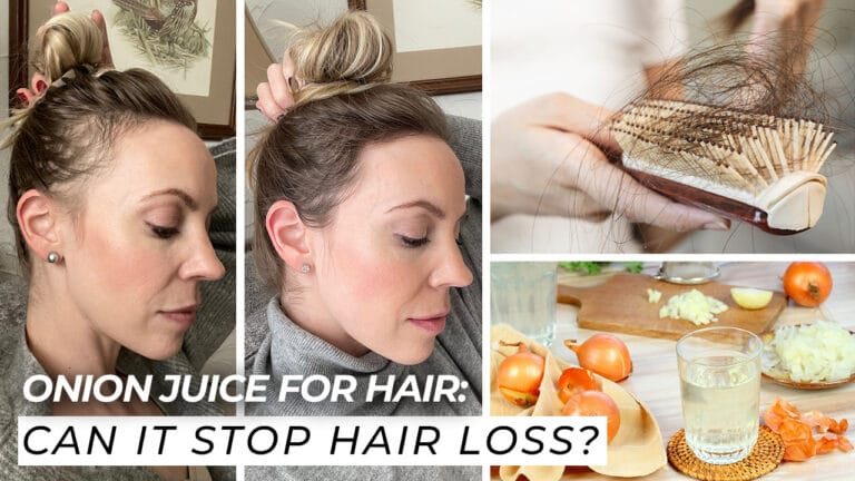 Onion-Juice-For-Hair-Can-It-Stop-Hair-Loss?